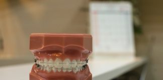 آموزش آشنایی با چگونگی انجام عمل جراحی دندان